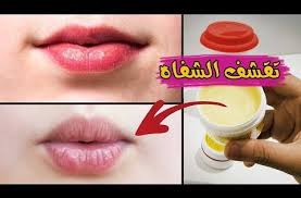 واخيرااا علاج تشقق الشفاه والقشور باستخدام زبدة الشيا Youtube