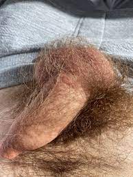 Is this at all normal to be this hairy? 🤔 : r/penis