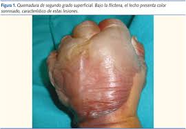 Forma