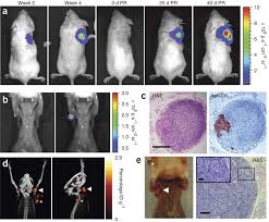 Prostate cancer is the most common type of cancer in men after skin cancer. Monitoring Lymph Node Metastasis In A Prostate Cancer Xenograft Download Scientific Diagram