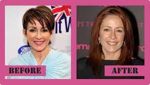 Before and after breast reduction Patricia Heaton Plastic Surgery Before And After
