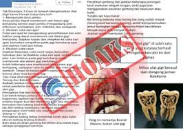 Gigi berlubang adalah kondisi di mana gigi mengalami kerusakan yang mengikis bagian luar (email) hingga bagian dalam gigi (dentin) gigi berlubang umumnya diawali oleh adanya plak pada mulut. Kementerian Komunikasi Dan Informatika