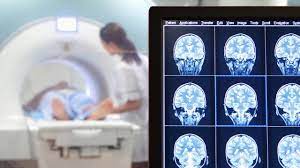 Mammographie Ab Wann Die Untersuchung Sinn Macht Focus Arztsuche