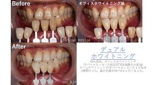 初雁歯科クリニック