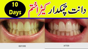 Pin On Home Remedy