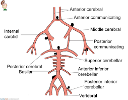 O aneurisma cerebral é uma dilatação num dos vasos sanguíneos que levam sangue até ao cérebro. Aneurisma Cerebral Na Tv Aneurisma Cerebral Sintomas E Cirurgia