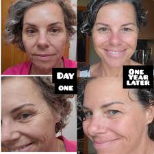 I'm obsessed with Celavive skincare." Find out more about USANA Athletes'  Meaghan Mikkelson #12!