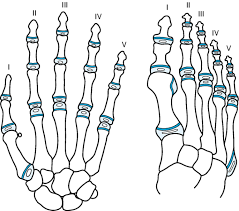 Image result for Hand Growth Plates