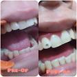 Tooth Jewellery Best Dental Clinic near me by Best Dentist product image