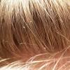 Head lice in brown hair head lice are small bugs that live exclusively in hair. 1