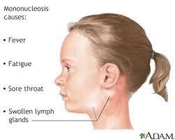 Lymph nodes are part of the lymphatic system, which is one of the body's defense mechanisms for the secondary stage of syphilis, often widespread sores on the mucous membranes and usually swelling of nodes in the neck or above the collarbone. Swollen Lymph Nodes Information Mount Sinai New York