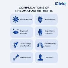 Image result for Rheumatoid Factor