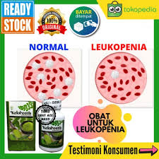 Sel darah putih (wbc) melawan infeksi dari bakteri, virus, jamur, dan patogen lainnya (organisme yang menyebabkan infeksi). Jual Obat Leukopenia Leukosit Rendah Kekurangan Sel Darah Putih Keloreena Jakarta Timur Toko Obat Ace Maxs Tokopedia