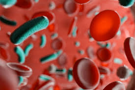 Image result for Sepsis