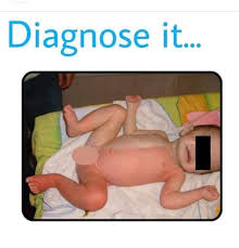 Image result for Harlequin Color Change