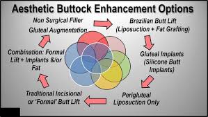 creating the ideal buttock lifting implanting or fat