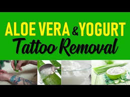 Does home tattoo removal work? Aloe Vera And Yogurt Tattoo Removal U Johnheller741