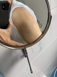 Visita il vaccino contro il vaiolo pagina web per saperne di più. Sergio Savoia On Twitter Ho Ancora La Cicatrice Del Vaccino Contro Il Vaiolo I Miei Figli No Perche Perche Grazie Al Vaccino Il Vaiolo E Stato Debellato Debelliamo Il Covid Allo