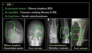 Pin De Eva Em Radiology 15 Radiologia