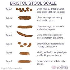 bristol stool chart a gutsy girl