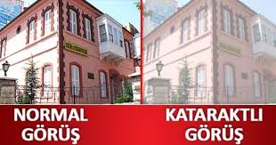 Katarakt Goz Icindeki Net Gormemizi Saglayan Seffaf Olan Mercegin Matlasmasi Veya Sislenmesi Ile Gorme Netliginin Bozulmasidir Gozler
