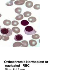 Red Blood Cell Morphology Grading Chart Download Table