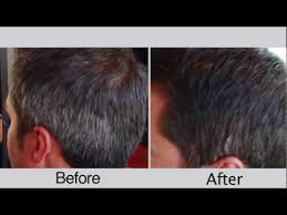 Before And After Mens Hair Color For Covering Gray Hair