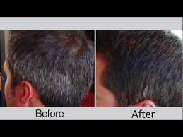 before and after mens hair color for covering gray hair