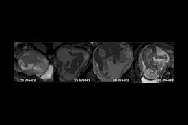 Study Shows How Hard Your Baby Is Kicking