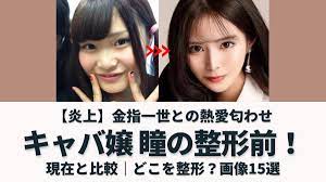 画像15選】キャバ嬢瞳(ひとみ)の整形前がやばい！無加工・昔の方が可愛い？