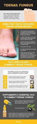 Toenail Fungus Natural Treatment Symptoms And Causes Dr Axe