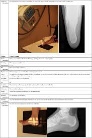 This video demonstrates the lateral recumbent position. Radiographic Positioning Radiology Key