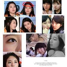 #artis korea cantik tanpa operasi plastik #bae suzy . Inikah Bukti Suzy Miss A Jalani Operasi Plastik Wajah Besar Besaran
