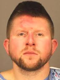 Man's Ear Bitten Off During Super Bowl Party