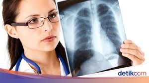 Nah, ada beberapa cara alami yang bisa anda lakukan untuk meredakan gejala pneumonia tersebut, yaitu Pneumonia Vs Paru Paru Basah Sama Atau Beda Ini Kata Dokter