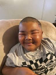 Brain Cancer Causes and Concerns