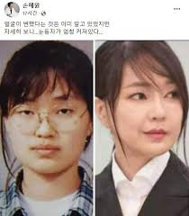 눈동자 커졌다?" "성형의 좋은 사례"…김건희 '옛날 사진' 등판