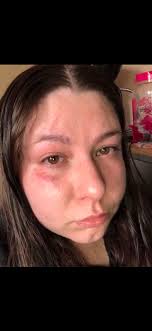 Recognizing narcissistic abuse and setting boundaries