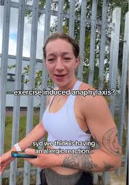Image result for Exercise-Induced Anaphylaxis