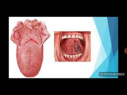 Anatomia Lengua Youtube