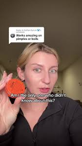 Prid Drawing Salve Removes 20-Year-Old Splinter