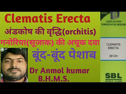 We did not find results for: Clematis Erecta 30 200 1m à¤—à¤¨ à¤° à¤¯ à¤¸ à¤œ à¤• à¤… à¤¡à¤• à¤· à¤• à¤µ à¤¦ à¤§ à¤à¤— à¤œ à¤® à¤¡ à¤…à¤¨à¤® à¤² à¤• à¤® à¤° Youtube