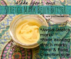 For stubborn marks that just won't go away, you may be tempted to focus entirely on treating them topically with creams and body butters. Diy Belly Butter Prevent Stretch Marks Naturally Diy Belly Butter Stretch Marks Natural Stretch Mark Cream