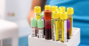 Blood cancers (including leukemia, lymphoma and myeloma) are more common in men than women. 10 Important Blood Tests What They Show Why They Re Done More