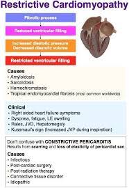 The following diagnostic tests can help you determine if a patient has myocarditis or another condition. Pin On Science Nature