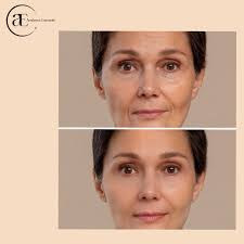 Smooth out the wrinkles of life." #aigenerated #fblifestyles