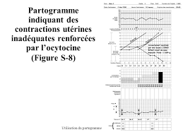 La tenue du partogramme, une prise en charge active du troisième stade du travail, la disponibilité des services 24 heures sur 24 et 7 jours par semaine, la perfusion intraveineuse, l'anesthésie et les succédanés du plasma (expanseurs volémiques). Prise En Charge Du Travail En Utilisant Le Partogramme Ppt Video Online Telecharger