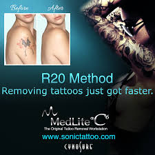If you've been looking for how to remove temporary tattoos, this is the easiest way to go! Fastest Way To Remove Tattoo