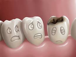 Help learn how to tell the differences between a cavity and sensitive teeth. How To See A Cavity Like A Dentist Kingstowne Family Dentistry