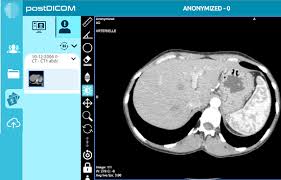 Remember, different programs may use dcm files for different purposes, so you may need to try out a few of them to be able to open your specific file. 5 Free Online Dicom Viewer Websites To Open And View Dcm Files